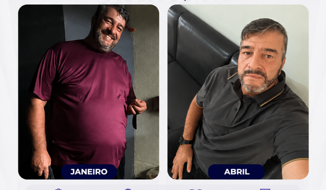 Colagem antes e depois de paciente da Emagrecentro Ponta Grossa comparando meses de tratamento, fotografia comparativa lado a lado, fotografia realista